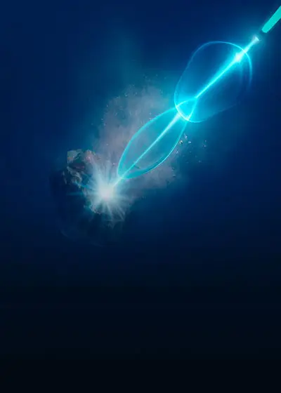 Lasersko razbijanje i uklanjanje bubrežnih kamenaca pomoću holmijum lasera