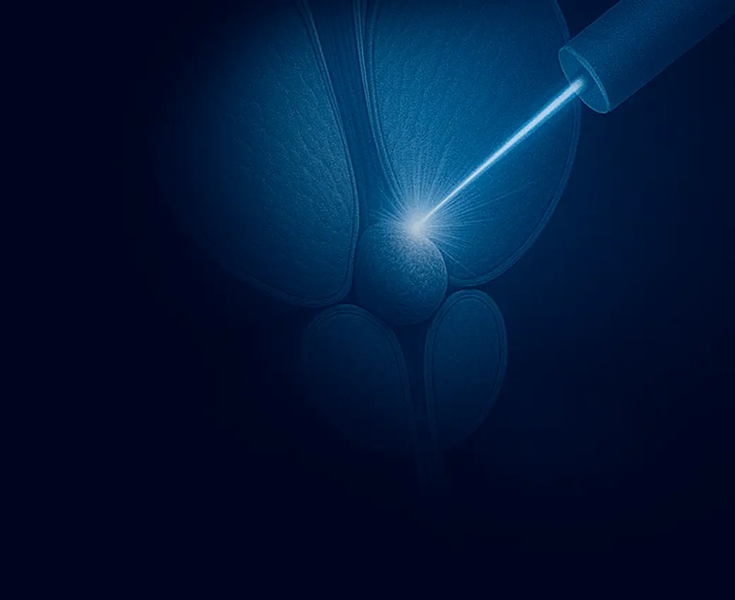 Laserska operacija prostate HoLEP metodom pomoću holmijum lasera