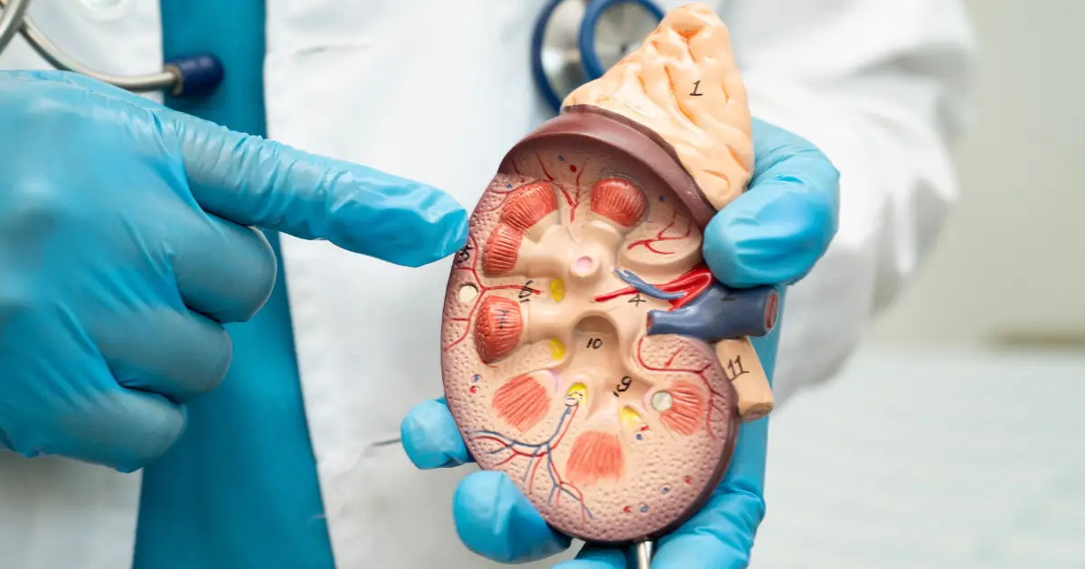 Kamen u bubregu - urolog pokazuje presek bubrega na anatomskom modelu